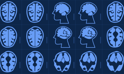 GE Healthcare Intel Nvidia medical imaging